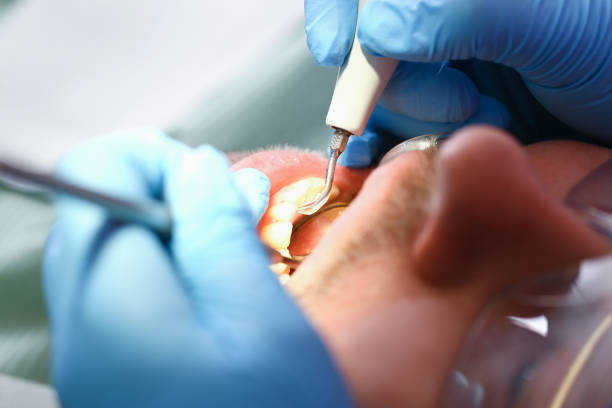 Best After-Hours Dental Trauma Care in Thompsonville, CT